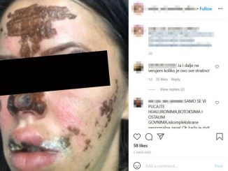 Leutar.net Beograđanke unakažene u salonu lepote: Kao žrtve požara smo